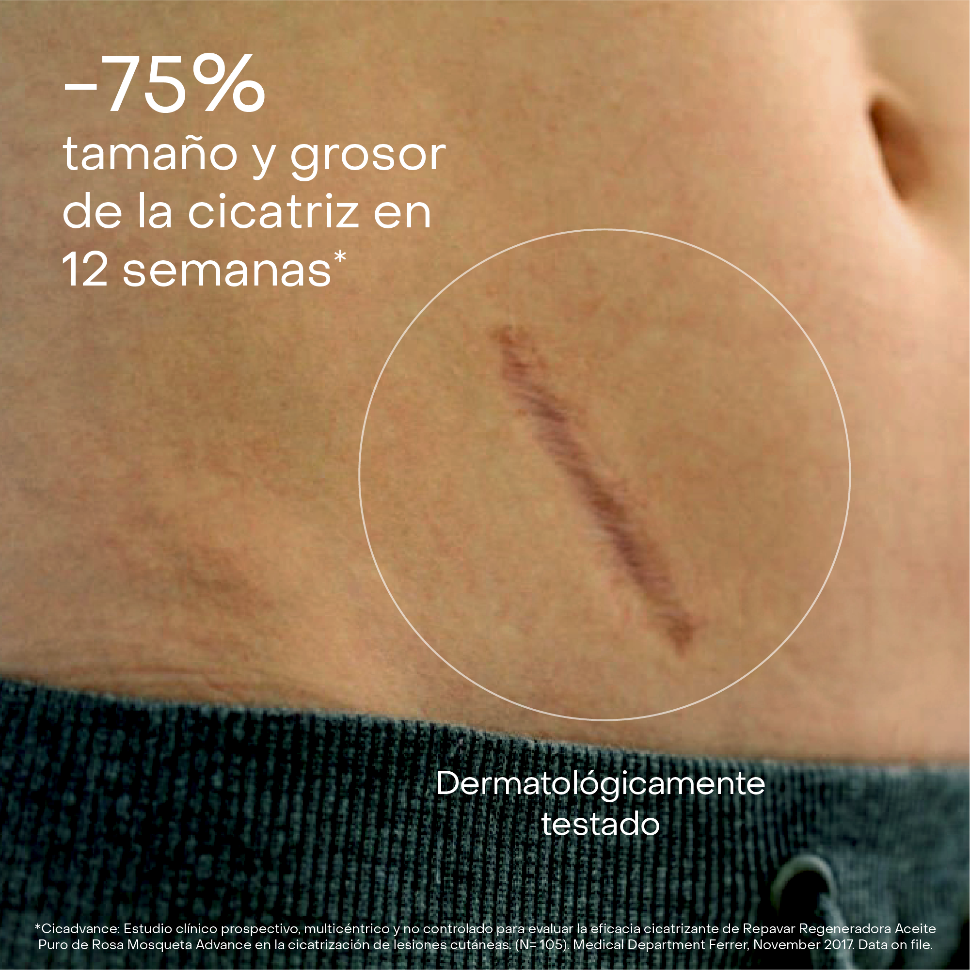 Regeneradora Aceite Puro de Rosa Mosqueta Advance - doble acción regeneradora de cicatrices