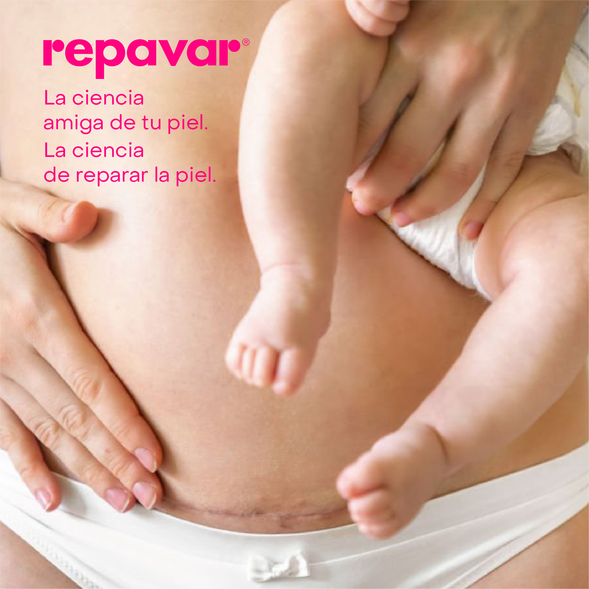 Regeneradora Aceite puro de rosa mosqueta - tratamiento de cicatrices y estrías