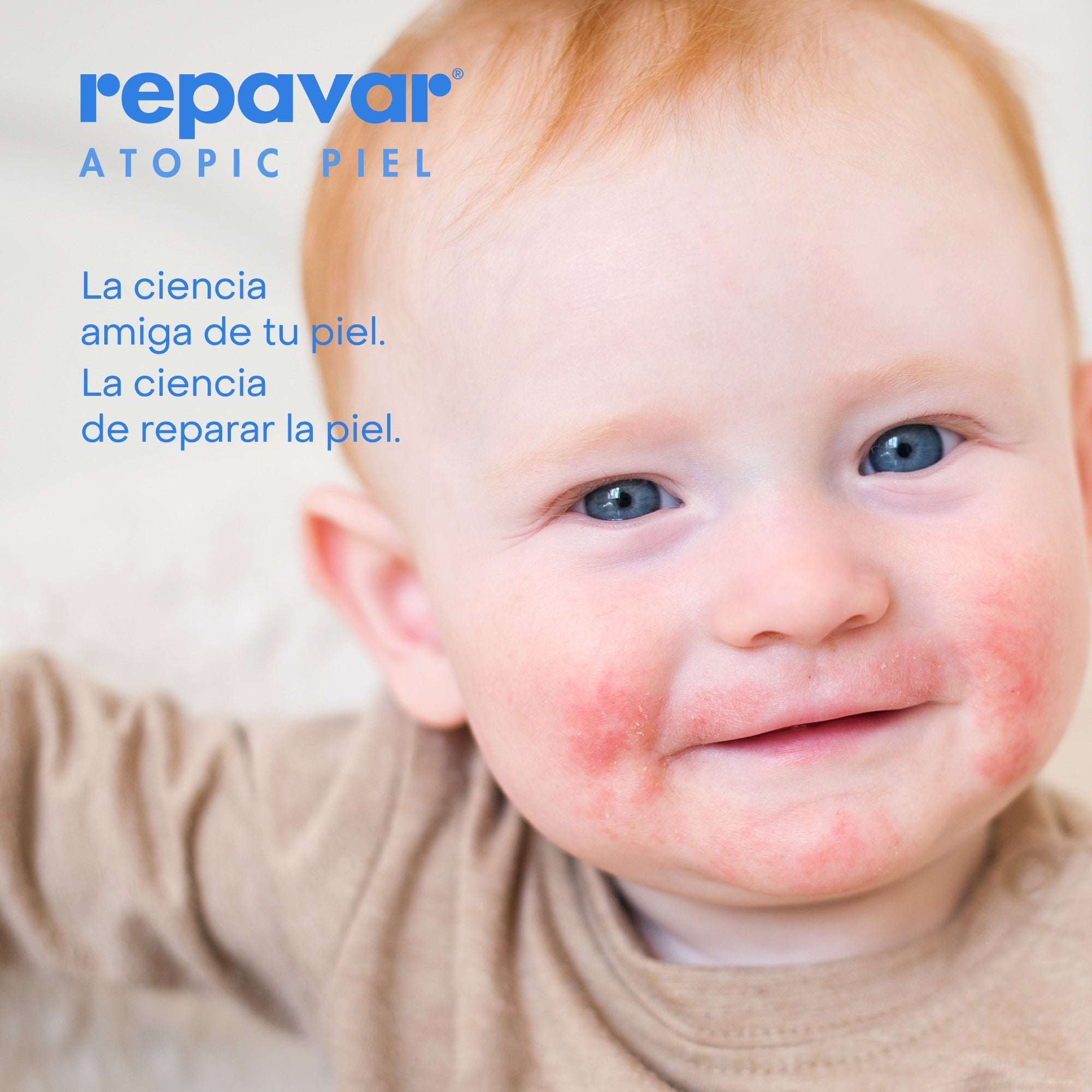 Atopic Piel Crema Corporal Extrem trata el brote de atopía, alivia el picor y refuerza barrera cutánea