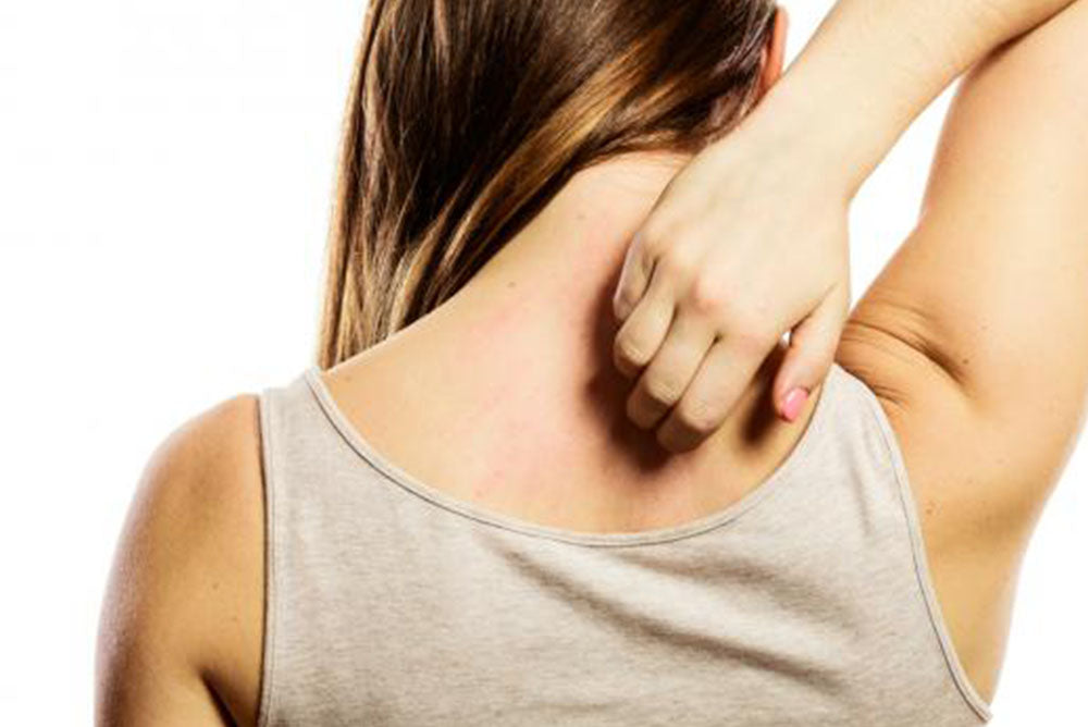 DERMATITIS ATÓPICA, ¿QUÉ ES Y EN QUÉ CONSISTE?